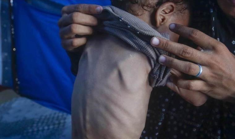 UN report warns of deepening hunger crisis in 16 global UN report warns of deepening hunger crisis in 16 global